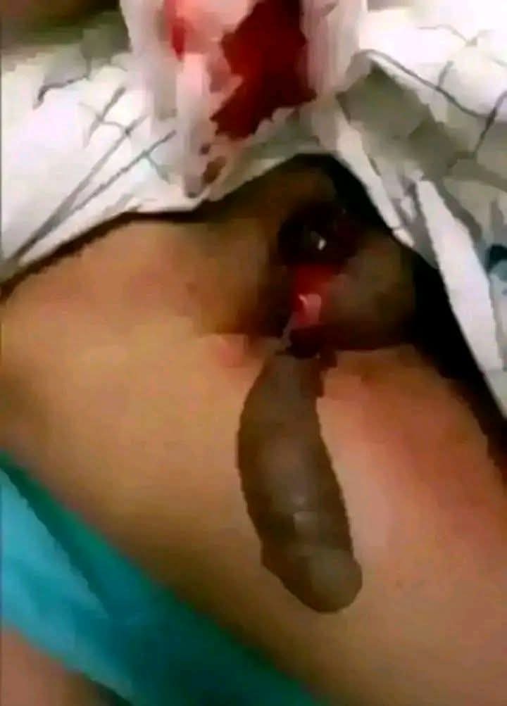 Woman Allegedly Cuts Off Boyfriend's Penis After Drugging Him Over Cheating Claims