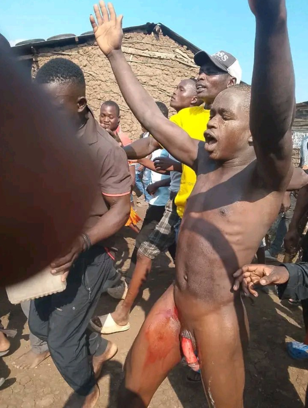 An Adult man circumcised during an African tradition 